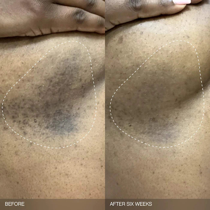 Set Faded para la decoloración del rostro y el cuerpo