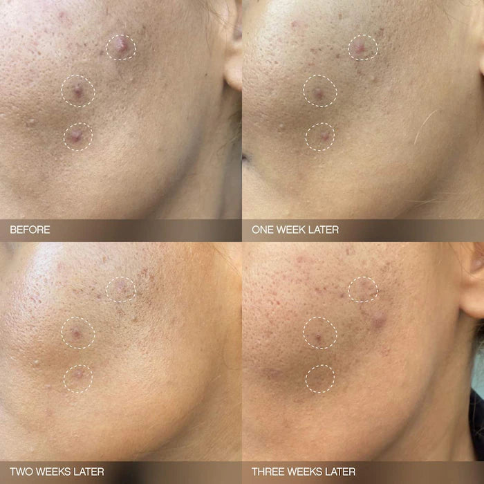 Set Faded para la decoloración del rostro y el cuerpo