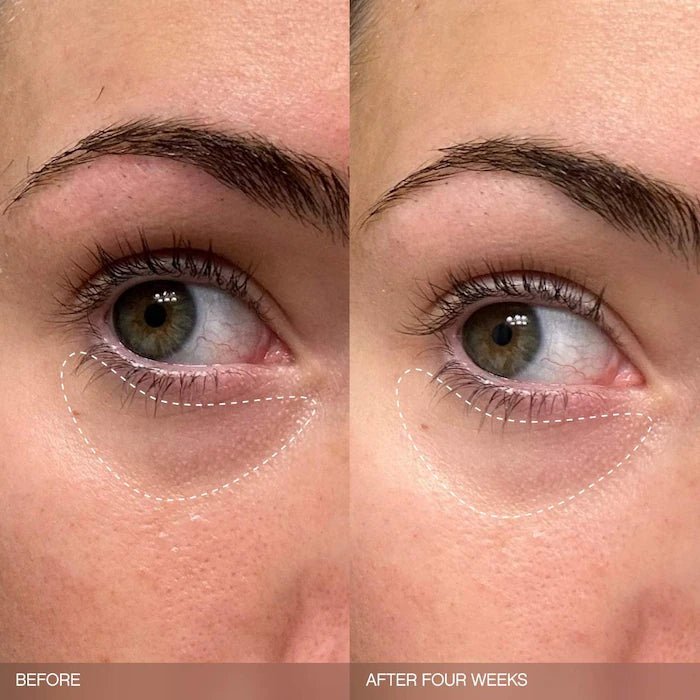 Set Faded para la decoloración del rostro y el cuerpo
