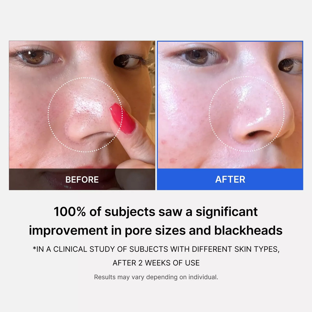 Zero Pore Pad Medicube